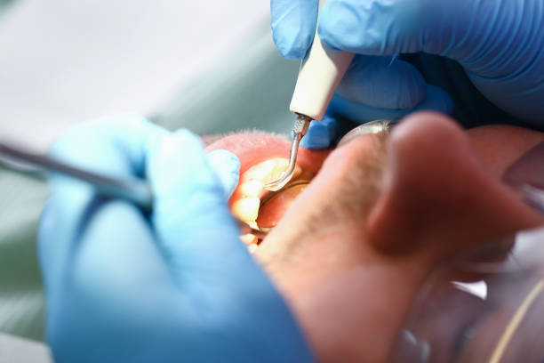 Professional Emergency Dentist in DE