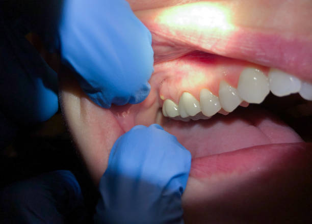 Best Emergency Dental Care for Trauma or Injury in Elsmere, DE